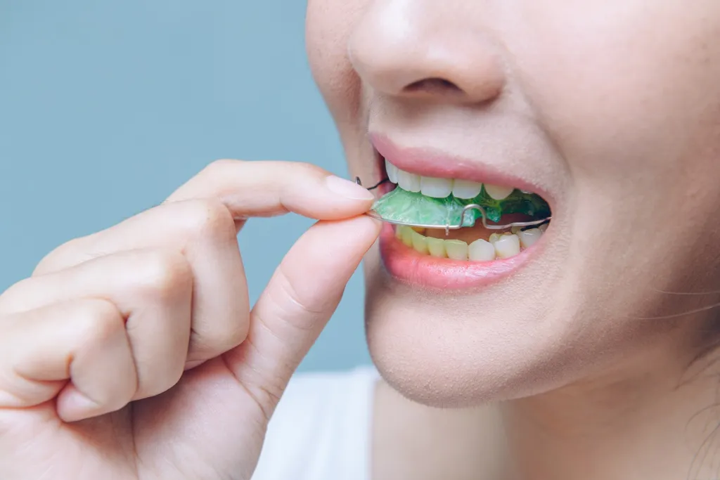 Can Retainers Realign Your Teeth?