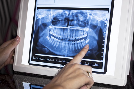 Dentist vs. Oral Surgeon: What is the Difference?