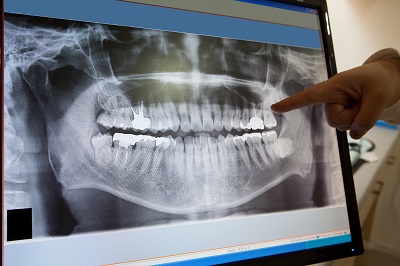 What is Considered Oral Surgery?