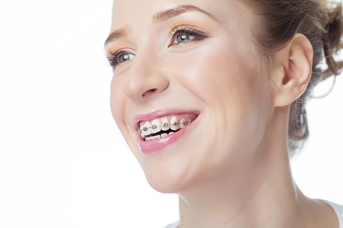 Questions to Ask When Looking for an Orthodontist